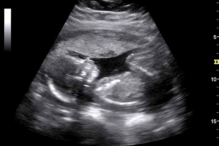 Ultrasounds in Montgomery AL  Southern Specialty Physicians